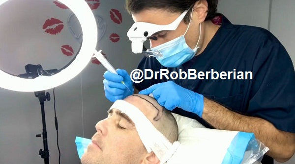 FUE vs FUT Hair Transplant: Secrets Revealed by Top Los Angeles Surgeon